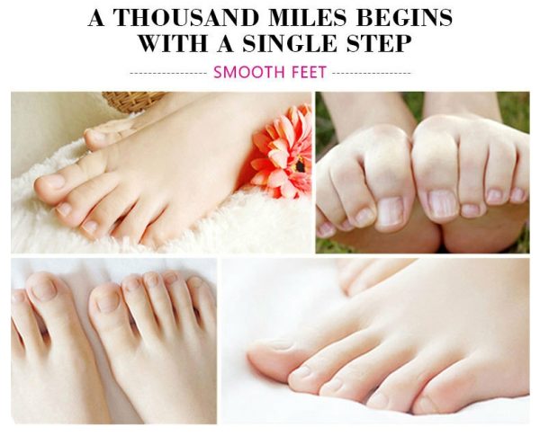 Aichun Beauty Banana Milk Cracked Heel Cream . - Image 5